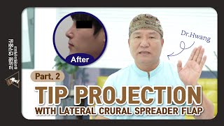 lateral crural turnover flaplateral crur al spreader flapcontracted nosetip projectiontipplasty [upl. by Eide339]