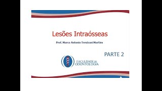 Estomatologia lesões intraósseas parte 2 [upl. by Oneida]