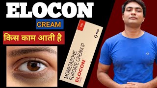 elocon cream for dark spots  elocon cream use on face  elocon cream ke fayde [upl. by Regni]