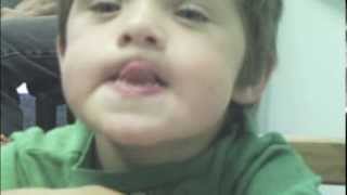 Dariens Journey with Childhood Apraxia of Speech [upl. by Isador]