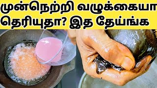 இனி ஒரு முடி கொட்டுனா 100 முடி முளைக்கும் Hair Growth Tips for Forehead in TamilHow To Regrow Hair [upl. by Rehpotsirh]