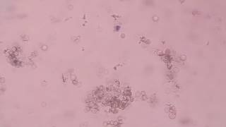 WBCs stained by New methylene blue supravital stain [upl. by Esyle]