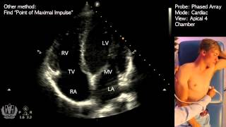 Apical 4 Chamber View on Transthoracic Echocardiography Cardiac Ultrasound [upl. by Llerat]