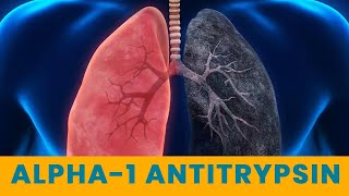 Alpha1 Antitrypsin  Causes Symptoms amp Treatment  DrNikhil Modi  Alpha One Antitrypsin [upl. by Noreen213]