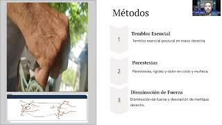 CC 11 Neuropatía periférica sensorial y osteoartrosis microtraumática [upl. by Emmanuel]