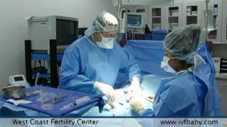 West Coast Fertility Centers Male Infertility Treatments [upl. by Ynottirb]