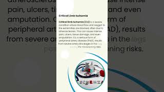 Explicating What Critical Limb Ischemia Is Shocking Truth by Dr Arun [upl. by Araeic]