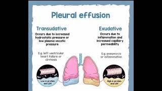 pleural effusion in lungs [upl. by Capone426]