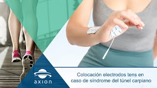 Colocación electrodos TENS para síndrome del túnel carpiano  Electroestimulación TENS [upl. by Alicsirp]