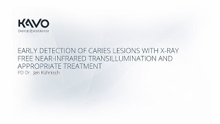 Early detection of caries lesions with Xray free infrared transillumination with Dr Jan Kuenisch [upl. by Filberto845]