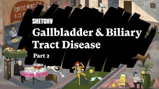 Gallbladder amp Biliary Tract Disease Part 2  Pathophysiology  Sketchy Medical  USMLE Step 1 [upl. by Yelnet]