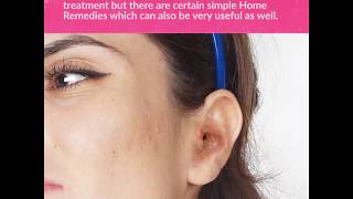 6 Effective Home Remedies to Get Rid of Swimmers Ear [upl. by Aprile]