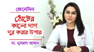 ঠোঁটের কালো দাগ দূর করার সহজ উপায়  Beauty Tips lip Care Bangla  DrNusrat Jahan  Doctor Tube [upl. by Attalie]