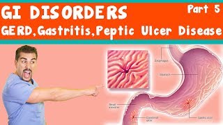 GI Disorders GERD Gastritis peptic ulcer Disease Part 5 [upl. by Thane]