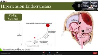 12 Hipertensión intracraneal [upl. by Maridel667]