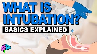 What is Intubation  The Basics Explained [upl. by Razaele]