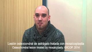 TESTIMONIO PACIENTE OPERADO DE OSTEOCONDRITIS DE ASTRAGALO [upl. by Santoro]