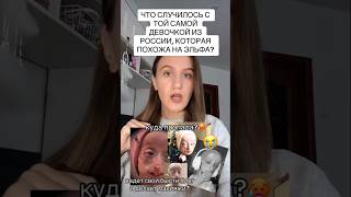 Что случилось с той самой девочкой из России которая похожа на эльфа 😱😳 [upl. by Jaine]