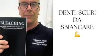 Denti scuri da sbiancare [upl. by Francesco]