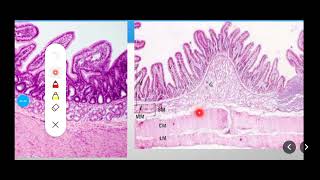 Histology Slides Series Episode 10  Histology of the Small Intestine Duodenum Jejunum Ileum [upl. by Yesnil]