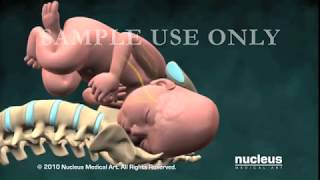 Nucleus Obstetrics and Gynecology Demo 2010 [upl. by Imat402]