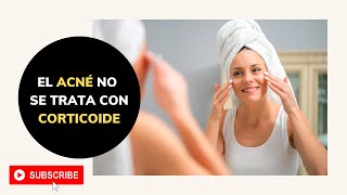 ACNÉ NO se trata con CORTICOIDE [upl. by Boarer677]