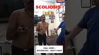 Chiropractic treatment in Udaipur  Scoliosis  Dr Varun Chiropractor  Call now  9313047251 [upl. by Key7]