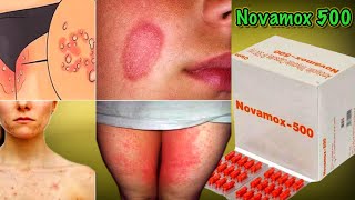 Novamox 500mg Capsule  Amoxicillin Trihydrate Capsule IP 500mg Capsule Full Detail In Hindi [upl. by Oramlub780]