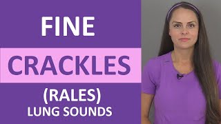 Fine Crackles Rales Lung Sound Causes Breath Sounds Audio Nursing [upl. by Sivle699]