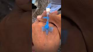 IV cannula insertiondocternursingmotivationviralvideoshortvideoivcannulashortvideolove [upl. by Yklam]