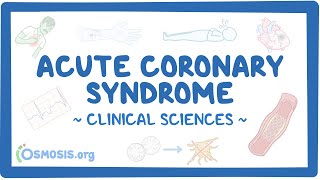 Acute coronary syndrome Clinical sciences [upl. by Irahcaz888]