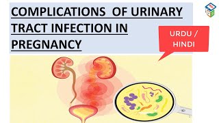 URINARY TRACT INFECTION PART2COMPLICATIONS OF UTI IN PREGNANCYY IT IS IMPORTANT TO DIAGNOSE n CURE [upl. by Piggy533]