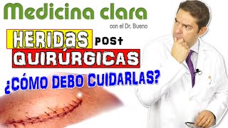 CUIDADO de CICATRICES y HERIDAS postquirúrgicas EN CASA Evitar MARCAS de HERIDAS  Medicina Clara [upl. by Deirdre360]