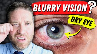 Why Dry Eyes Cause Blurry Vision  3 Reasons And 3 Home Remedies [upl. by Cherilynn]