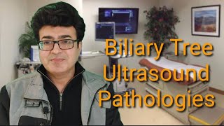 Biliary Tree Ultrasound [upl. by Yajeet343]