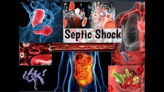 Sepsis And Septic Shock [upl. by Imar340]