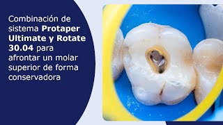 Combinación de Protaper Ultimate y Rotate 3004 para afrontar un molar superior Forma conservadora [upl. by Rebe]