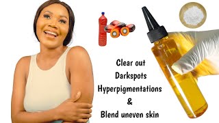 How To Make Glow Oil to Clear Darkspots Hyperpigmentation amp Skin Discolourations [upl. by Par]