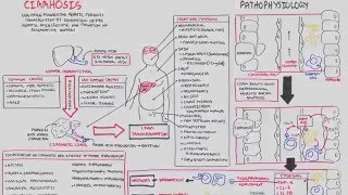 Liver Cirrhosis SandS Pathophysiology Investigations Management [upl. by Desi715]