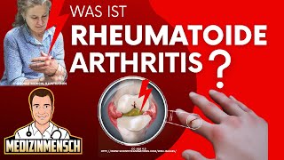 Rheumatoide Arthritis deutsch — Rheumatologe erklärt RHEUMA [upl. by Aleet22]