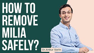 All about milia and how to remove Milia safely at home  Dr Ankur Sarin [upl. by Cline]