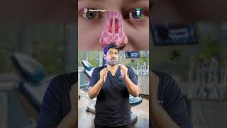 வாய் வழியாக மூச்சு விடுவதை தடுப்பது எப்படி How to Stop Mouth Breathing Habit Denta Kings shorts [upl. by Adnawyek]