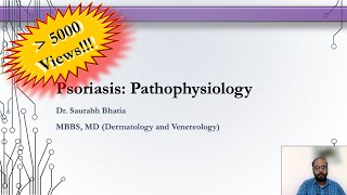 Psoriasis  Pathophysiology [upl. by Seiter172]