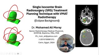 Single Isocenter Brain Radiosurgery SRS Treatment Planning Technique with VMAT Radiotherapy [upl. by Ardnusal]