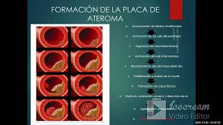 Cardiopatía isquémica I  AngioCardiología  sem 6 [upl. by Domini]