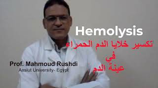 Hemolysis of a blood sample تكسير خلايا الدم الحمراء [upl. by Nnylsoj]