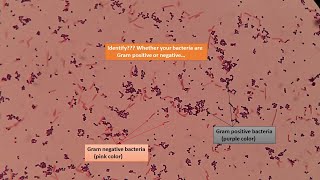 Gram positive and Gram negative bacterial slides under the Microscope [upl. by Karalynn]