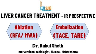 Ablation chemoembolization and radioembolization in primary liver cancer  hepatocellular carcinoma [upl. by Devinne692]