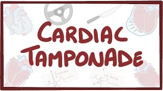 Cardiac tamponade  causes symptoms diagnosis treatment pathology [upl. by Lillywhite848]