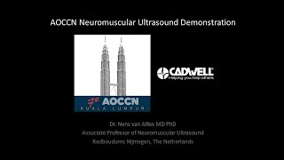 Neuromuscular Ultrasound Demonstration AOCCN 2021 Nens van Alfen MD PhD [upl. by Chesna151]